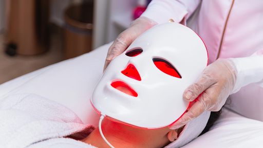 Laser treatment for rosacea Nashville